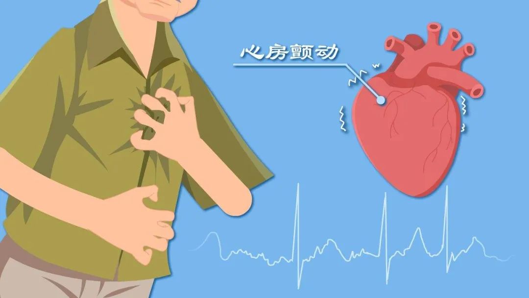 科普 | 關(guān)于房顫的你了解多少？快避開這些誤區(qū)！