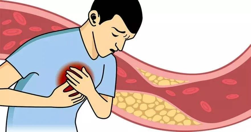 高膽固醇不能吃雞蛋？膽固醇也有“好壞”之分！